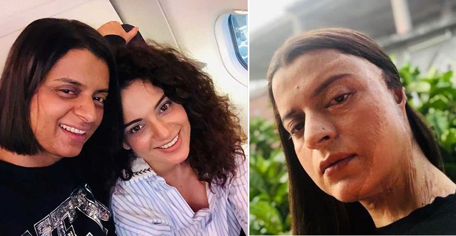 Kangana Ranaut's Sister Rangoli Reveals The Name Of Her Ac`id A`ttacker ...