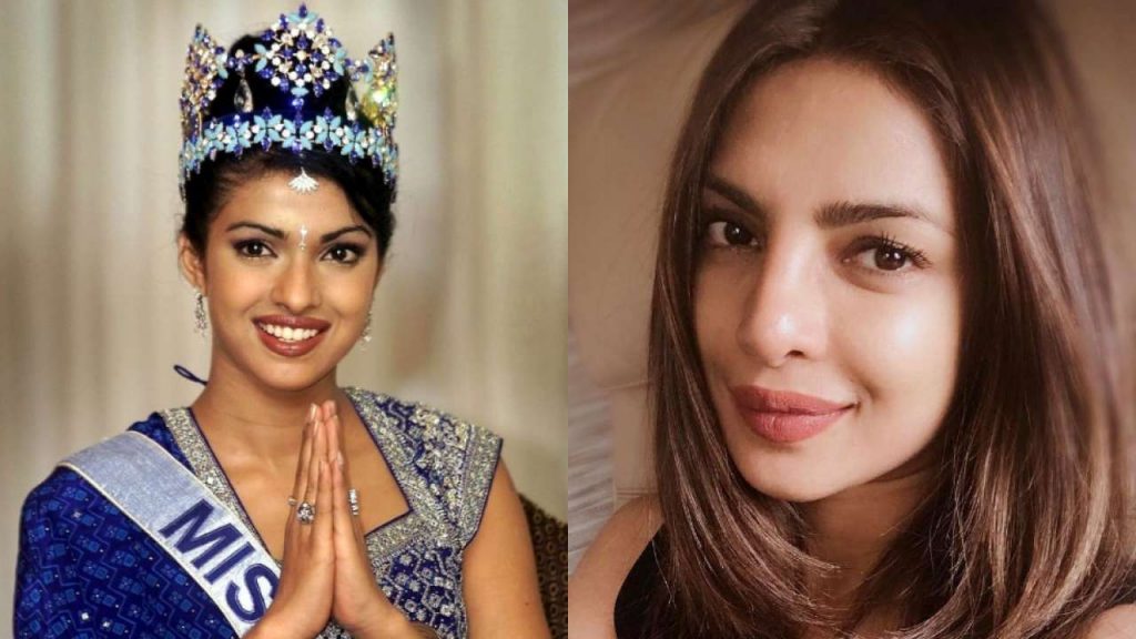 Priyanka Chopra Opens On The 'Plastic Chopra' Tag After Surgery Went ...